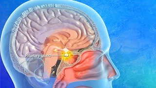 Endoscopic Transsphenoidal Pituitary Surgery Explained [upl. by Selle]