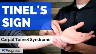 Tinels Sign for Carpal Tunnel Syndrome [upl. by Mobley677]