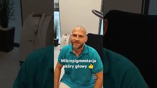 Mikropigmentacja skóry głowy Szczecin hair mikropigmentacjaprzeszczepwlosów [upl. by Ettegroeg]