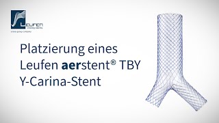 Platzierung eines Leufen aerstent® TBY [upl. by Sibie]