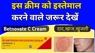 Betnovate c skin cream review  Betnovate c lagane se kya hota hai [upl. by Fritz649]