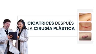 Tipos de cicatrices después de la cirugía plástica 👩🏻‍⚕️ [upl. by Dunston722]