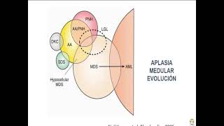 Hematología  4 Aplasia medular [upl. by Fawcette900]