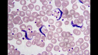 Trypanosoma cruzi PIA microbiologia UANL [upl. by Ribble]