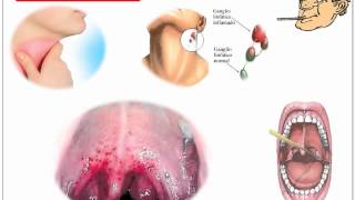 Streptococcus Pyogenes [upl. by Anuhsal]