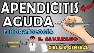 APENDICITIS AGUDA📝Fisiopatología SignosSíntomas y TratamientoESCALA DE ALVARADO Interpretación [upl. by Tildy]