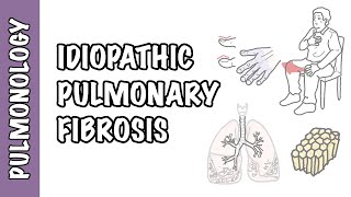 Idiopathic Pulmonary Fibrosis  pathophysiology signs and symptoms investigation and treatment [upl. by Hgieloj]