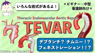 【TEVARの術式をマスターしよう！】デブランチ？チムニー？フェネストレーション？ [upl. by Leventis]