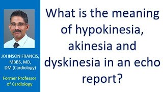 What is the meaning of hypokinesia akinesia and dyskinesia in an echo report [upl. by Ydnik]