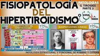 HIPERTIROIDISMO FISIOPATOLOGÍA  GuiaMed [upl. by Yrollam]