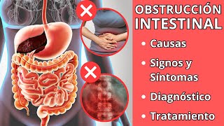 OBSTRUCCIÓN INTESTINAL  Causas signos y síntomas diagnóstico y tratamiento [upl. by Annaed658]