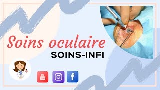 soins oculaire  soins infirmiers  ophtalmologie [upl. by Tilagram]