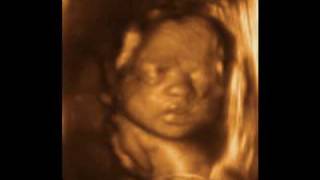 28 Weeks Baby 3D 4D Ultrasound  My Sunshine Baby Charlotte [upl. by Narba]