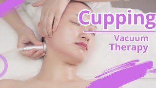 Vacuum Therapy  Vacuum Therapy Cup Massage  Vacuum Cupping Therapy  Lymphatic Drainage [upl. by Nytsuj]