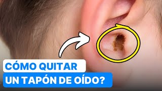 ¿Cómo Quitar un Tapón de Cera aceite de oliva velas 😮 [upl. by Nonna871]