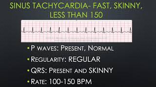 Breaking Down BASIC Dysrhythmias [upl. by Simsar]