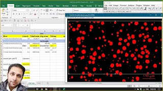 Particle count and Area Fracture study for Spheroidal Graphite Ductile Cast Iron [upl. by Eserehc]