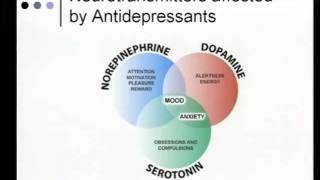 Medical Approach to Neuropathic Pain and Paresthesias [upl. by Sesylu45]