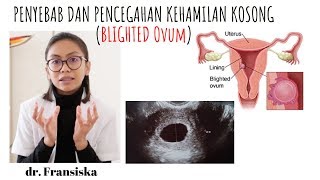 HAMIL KOSONG ATAU BLIGHTED OVUM BO  APA PENYEBABNYA DAN PENCEGAHANNYA [upl. by Cosma]