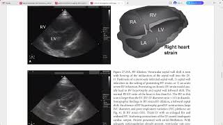 CLINICAL EMERGENCY RADIOLOGY CAMBRIDGE [upl. by Arimahs]