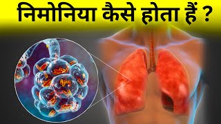 निमोनिया कैसे होता हैं  pneumonia etiology amp pathophysiology [upl. by Ainesy192]