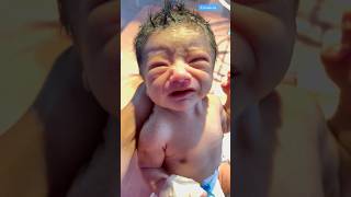 Newborn babies crying medical viralvideo [upl. by Laet]