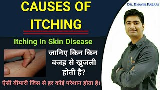 CAUSES OF ITCHING  Itching in skin diseases amp other causes  Differencial Diagnosis of itching [upl. by Florie]