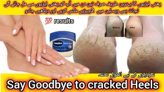 Good Bye to cracked heels100 resultsKOMAL beauty voice [upl. by Nawj]