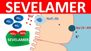 Sevelamer carbonate tablets for elevated phosphate levels [upl. by Stevenson]