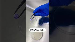 Oxidase Reaction Test  Disc Oxidase Test  Positive Oxidase Reaction microbiology youtubeshorts [upl. by Galanti]