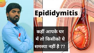 Epididymitis हिंदी में  Explained by K Amitesh singh [upl. by Otnas]