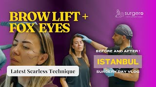 browlifting and foxeyes Surgery VLOG Surgero İstanbul Türkiye [upl. by Esiralc]