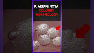 quot pseudomonas aeruginosa quot colony morphology [upl. by Derby252]