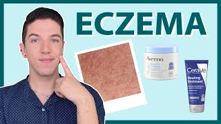 Eczema How to Treat amp Get Rid of It [upl. by Marillin189]