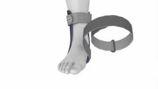 Bauerfeind MalleoLoc® Ankle Brace [upl. by Eiraminot]