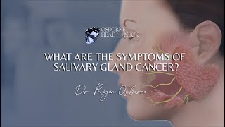 What are the symptoms of salivary gland cancer [upl. by Crosley348]