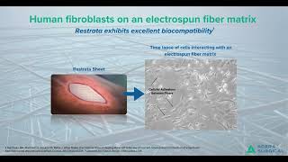 Human Fibroblasts on an Electrospun Fiber Matrix [upl. by Ezechiel956]