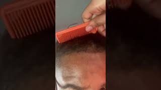 Combing out dandruff out husband dreads ASMRasmrvideo dandruff dandruffremoval [upl. by Mallen]