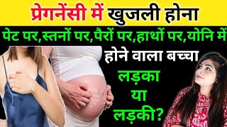 प्रेगनेंसी में खुजली l Itching During Pregnancy l Symptoms Of Baby Boy Or Girl [upl. by Trenna]