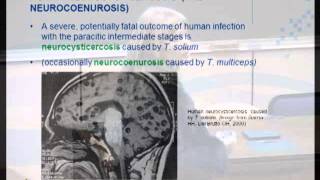 Taenia solium cysticercosis Life cycle epidemiology and diagnosis Dr L Odendaal [upl. by Boulanger]