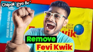 Feviquick Remover From Hand  How To Remove Feviquick From Hand [upl. by Ainat446]