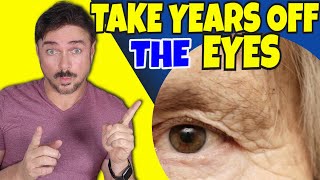 Take 20 Years Off Your Eye Area  Chris Gibson [upl. by Kingston954]