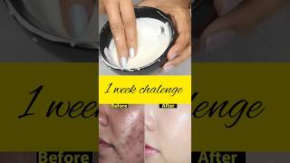 diy face cream get smooth eventone glowing skin viral skincare glow ytshorts diy cream [upl. by Enobe]