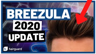 BREEZULA 2020 Update When Can YOU Start It For Hair Growth [upl. by Bobette]