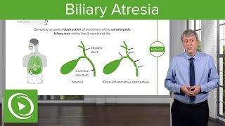 Biliary Atresia – Pediatrics  Lecturio [upl. by Artaed669]