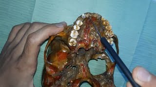 skull foramina identification amp structures passing through practical عربي [upl. by Kcirddes]