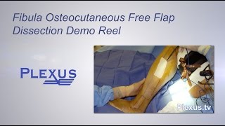 Fibula Osteocutaneous Free Flap Dissection Video [upl. by Hannahc949]