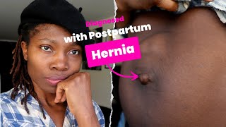 Suffering From UMBILICAL Hernia Postpartum Hernia After Pregnancy Waiting For Surgery [upl. by Silevi]