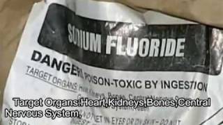 Workers at Water Plant Film Fluoride Toxicity [upl. by Nezah861]