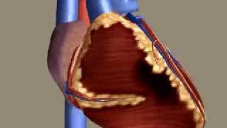 Myocardial Infarction [upl. by Skerl381]